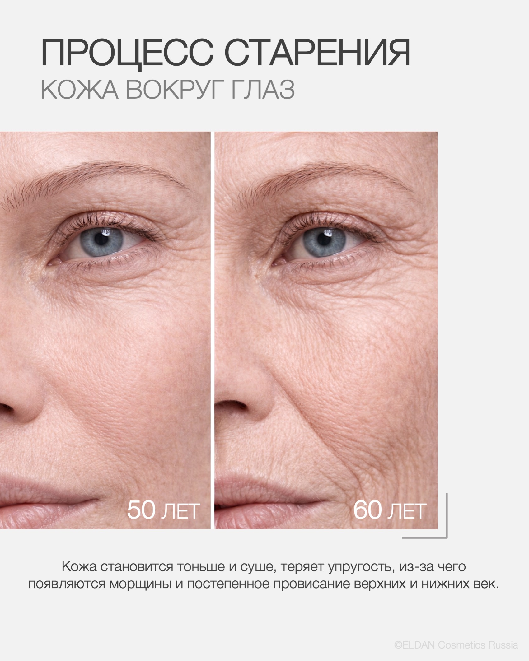 Пост старение кожи вокруг глаз 4.jpg Пост старение кожи вокруг глаз 4.jpg